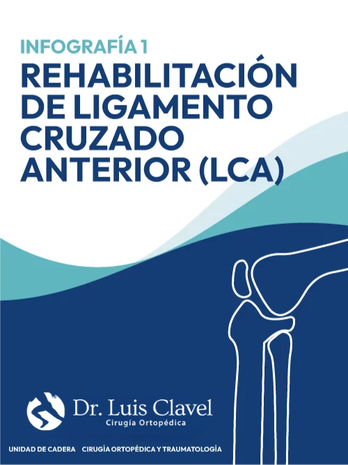 Doctor Luis Clavel | Infografía 1: Rehabilitación de Ligamento Cruzado Anterior